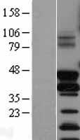 Fos B (FOSB) Human Over-expression Lysate