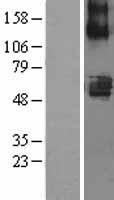 SLC22A7 Human Over-expression Lysate