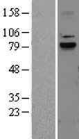 Calpain 9 (CAPN9) Human Over-expression Lysate