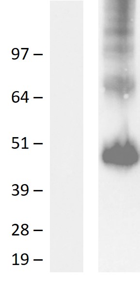 CD200 Human Over-expression Lysate