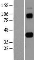 AIM (CD5L) Human Over-expression Lysate