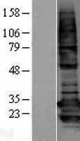 BAP31 (BCAP31) Human Over-expression Lysate