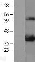 LDHA Human Over-expression Lysate