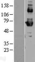 SCARB1 Human Over-expression Lysate