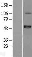 P2X6 (P2RX6) Human Over-expression Lysate