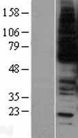 c-Myb (MYB) Human Over-expression Lysate