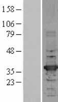 HADHSC (HADH) Human Over-expression Lysate