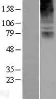 COL8A2 Human Over-expression Lysate