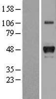 Haptoglobin (HP) Human Over-expression Lysate