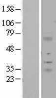 ITM2A Human Over-expression Lysate