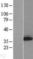 GGPS1 Human Over-expression Lysate