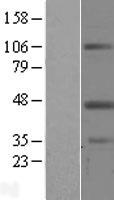 Leupaxin (LPXN) Human Over-expression Lysate