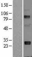 Adiponectin (ADIPOQ) Human Over-expression Lysate