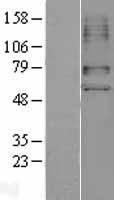 SLC22A6 Human Over-expression Lysate