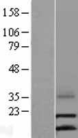 LEC (CCL16) Human Over-expression Lysate
