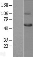 TGF beta Receptor I (TGFBR1) Human Over-expression Lysate