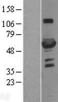 PFKFB3 Human Over-expression Lysate