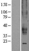 Estrogen Related Receptor beta (ESRRB) Human Over-expression Lysate