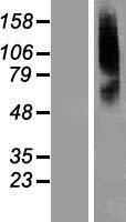 SLC22A8 Human Over-expression Lysate
