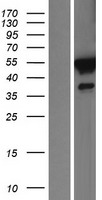 FKBP51 (FKBP5) Human Over-expression Lysate