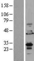 EMX2 Human Over-expression Lysate