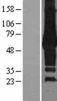 SQSTM1 Human Over-expression Lysate