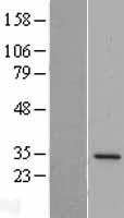 DPM1 Human Over-expression Lysate