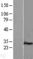 PEX11B Human Over-expression Lysate