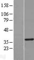 TRADD Human Over-expression Lysate