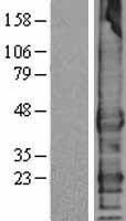 TMEFF1 Human Over-expression Lysate