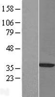 Pirin (PIR) Human Over-expression Lysate