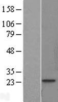 TNNI1 Human Over-expression Lysate