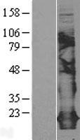 Claudin 5 (CLDN5) Human Over-expression Lysate