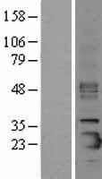 SFTPC Human Over-expression Lysate