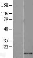 MCP1 (CCL2) Human Over-expression Lysate