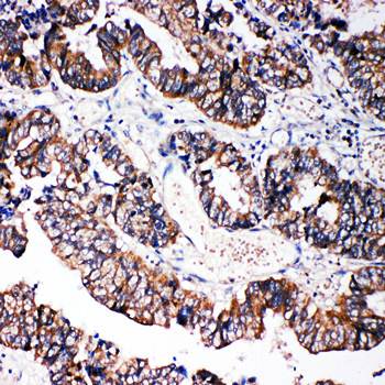 Caspase-3/CASP3 Rabbit Polyclonal Antibody