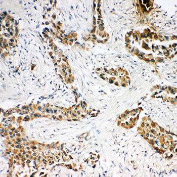 Caspase-3/CASP3 Rabbit Polyclonal Antibody