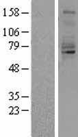 Quiescin Q6 (QSOX1) Human Over-expression Lysate