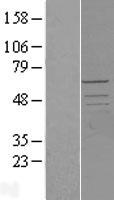 PCTAIRE2 (CDK17) Human Over-expression Lysate