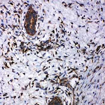 CD163 Rabbit Polyclonal Antibody