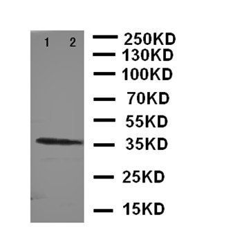 CD163 Rabbit Polyclonal Antibody
