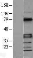 MYD88 Human Over-expression Lysate