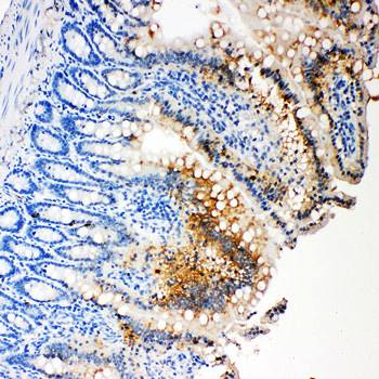 Caspase-3/CASP3 Rabbit Polyclonal Antibody