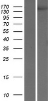 VEGF Receptor 2 (KDR) Human Over-expression Lysate