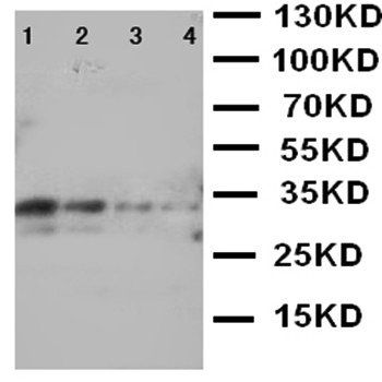LTK Rabbit Polyclonal Antibody