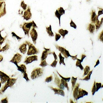 PDK2 Rabbit Polyclonal Antibody