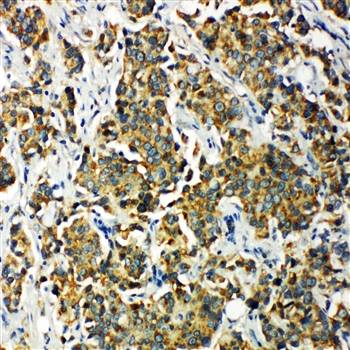 PDK2 Rabbit Polyclonal Antibody