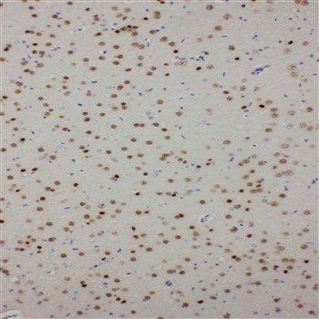 PDK2 Rabbit Polyclonal Antibody