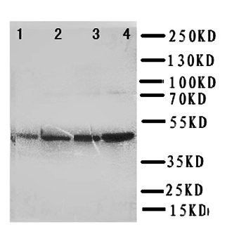 PDK2 Rabbit Polyclonal Antibody