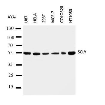 Selenocysteine lyase SCLY Rabbit Polyclonal Antibody